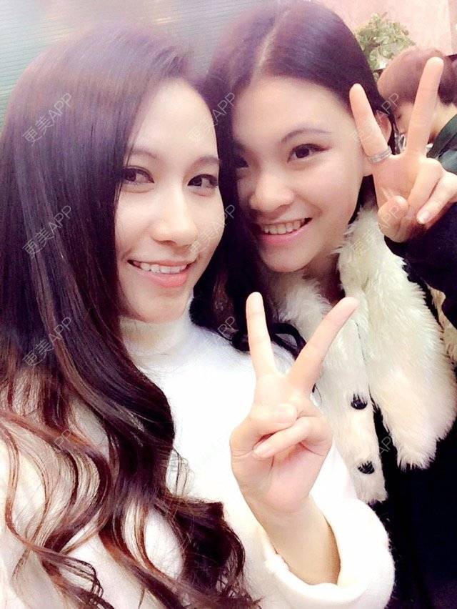 更美 - 失眠的kiki的冷光美白经验 | 广州 | 冷光美白