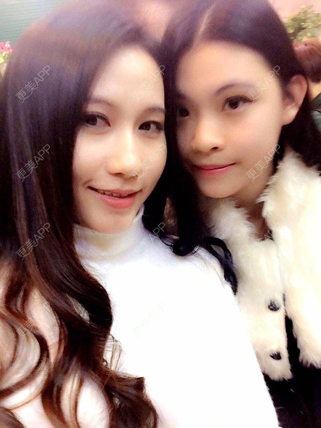 更美 - 失眠的kiki的冷光美白经验 | 广州 | 冷光美白