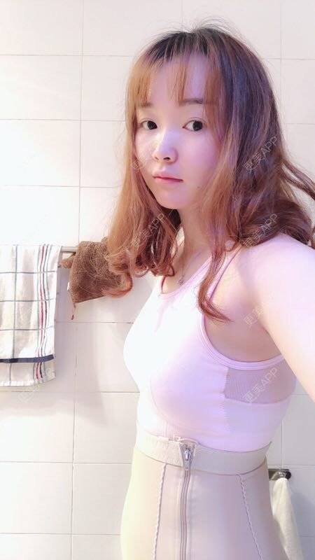 tony的自体脂肪隆胸日记