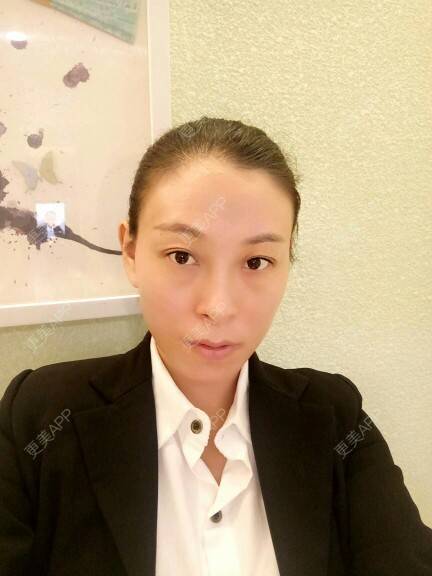 更美 - 更美用户U4W0Epddqe的像素激光经验 | 像素激光 | 深圳