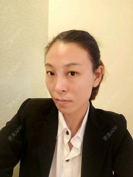 更美 - 更美用户U4W0Epddqe的像素激光经验 | 像素激光 | 深圳