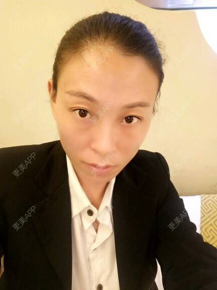 更美 - 更美用户U4W0Epddqe的像素激光经验 | 像素激光 | 深圳