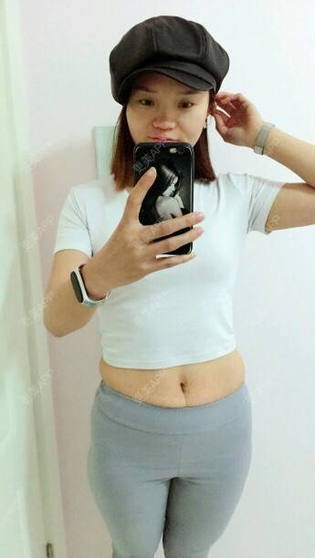 成都 | 视频日记 | 成都同城 | 产后修复 | 妊娠纹