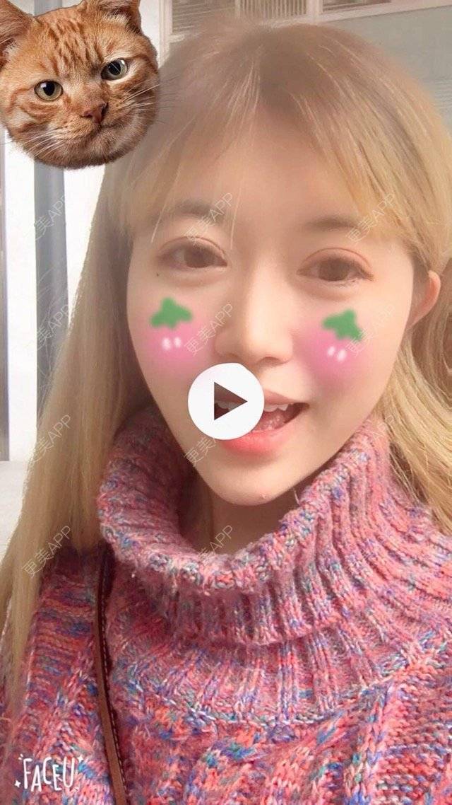 更美 - 诗情画意不够美的全切双眼皮经验 | 内开眼角 | 眼睛大小 | 长沙 | 全切双眼皮