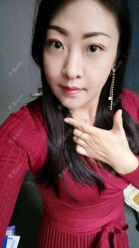 更美 - 别人都羡慕我的美的鼻部多项经验 | 广州 | 全脸整形套餐 | 面部轮廓 | 全面部提升 | 眼部多项 | 全切双眼皮 | 鼻翼缩小 | 鼻部多项