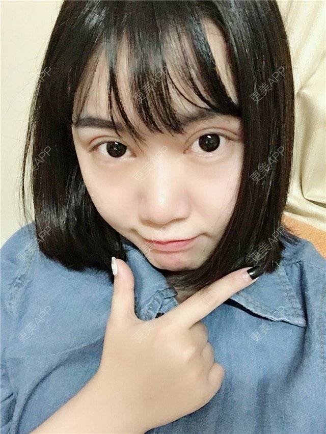 瑶瑶小小仙女的双眼皮日记