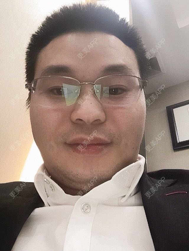更美 - 项美连 医生的清洁补水经验 | 广州 | 清洁补水