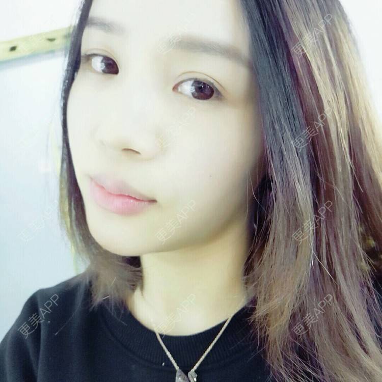 更美 - 更美用户NV7JIp6Bfc的玻尿酸唇部经验 | 玻尿酸唇部 | 武汉