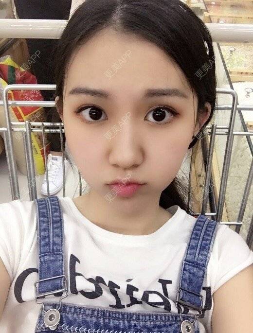 刘湘 医生的整形分享【多图】_更美app官网