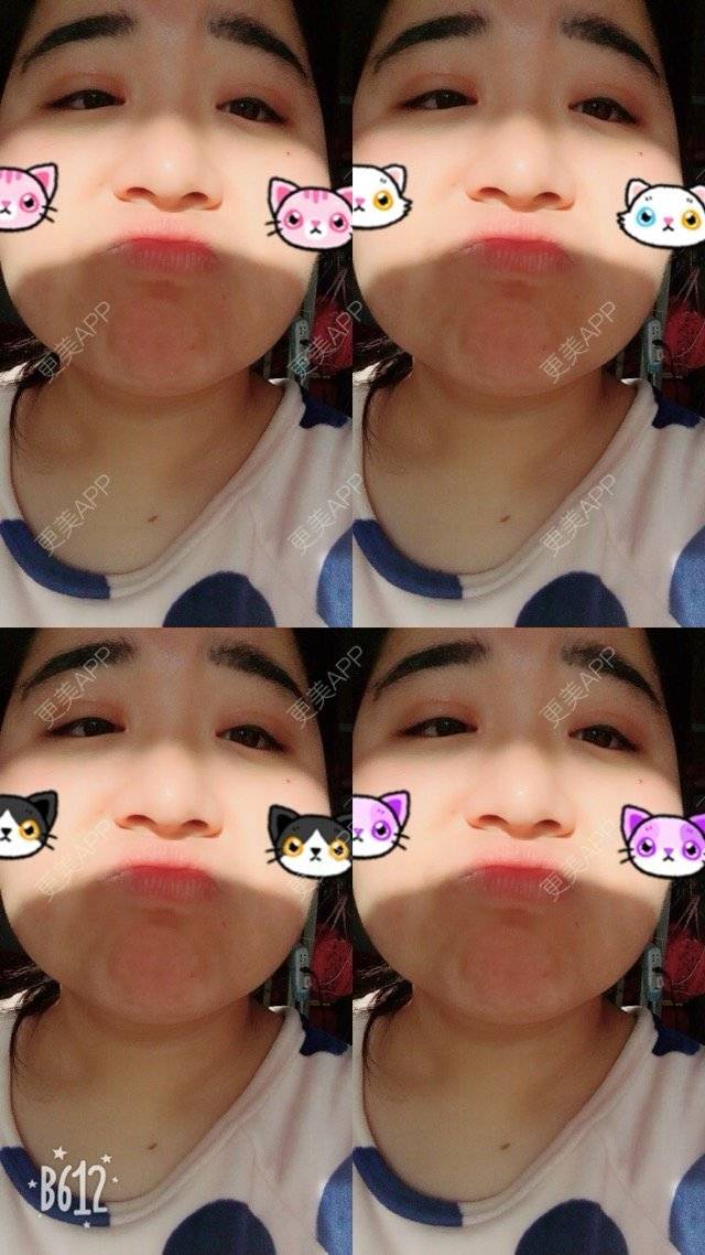 更美 - 超甜超甜的双眼皮经验 | 北京 | 视频日记 | 双眼皮