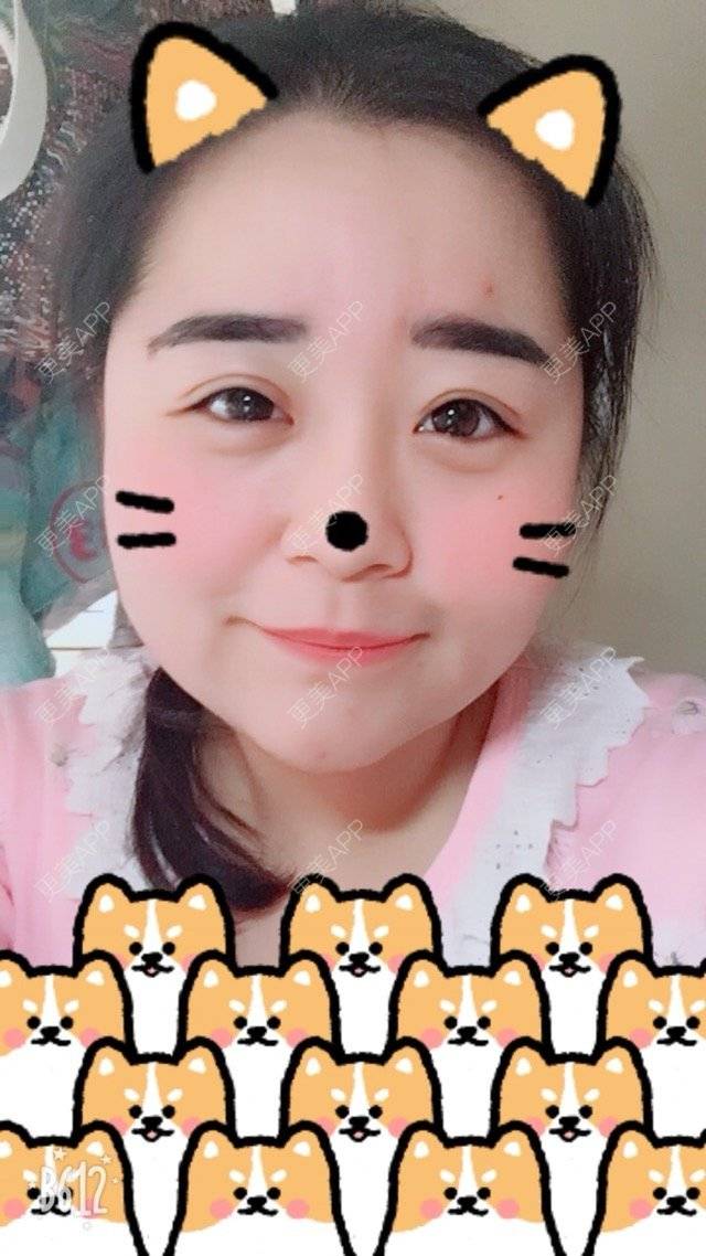 更美 - 超甜超甜的双眼皮经验 | 北京 | 视频日记 | 双眼皮