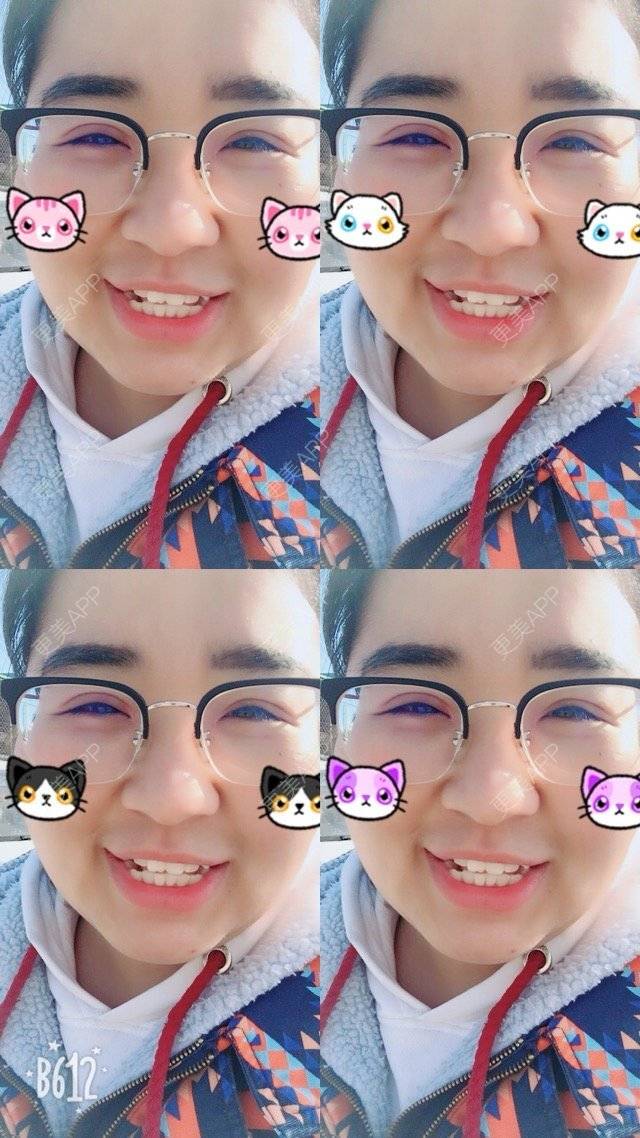 更美 - 超甜超甜的双眼皮经验 | 北京 | 视频日记 | 双眼皮