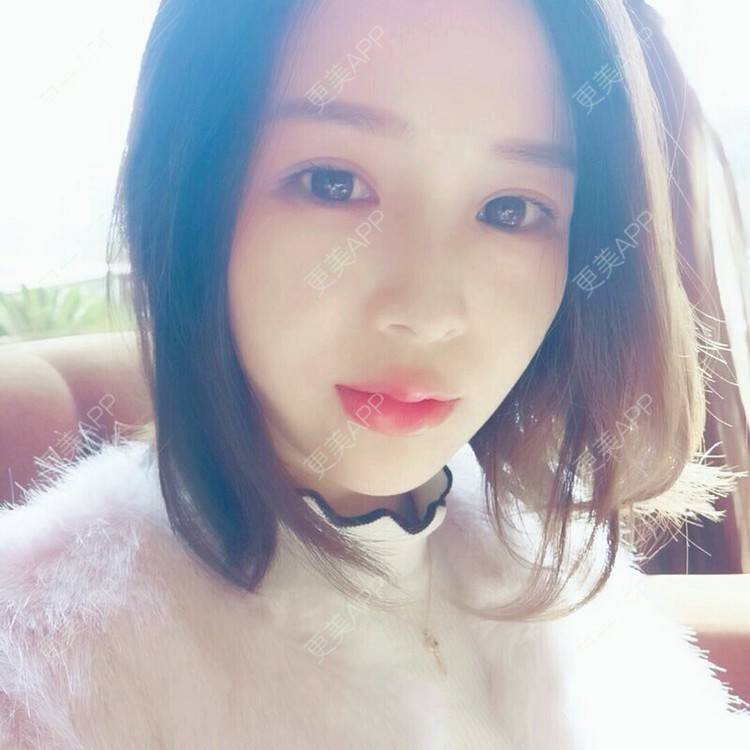 更美 - 更美用户NV7JIp6Bfc的玻尿酸唇部经验 | 玻尿酸唇部 | 武汉