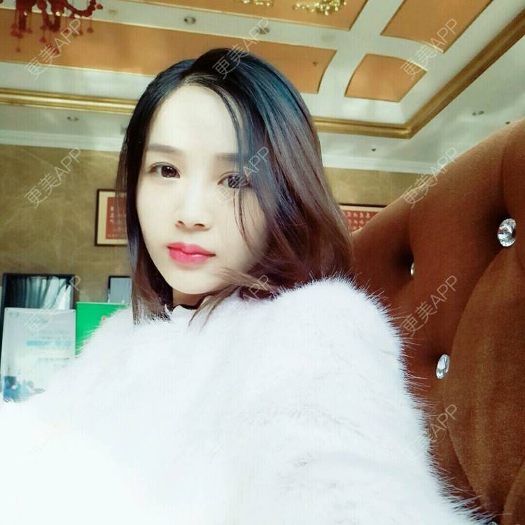 更美 - 更美用户NV7JIp6Bfc的玻尿酸唇部经验 | 玻尿酸唇部 | 武汉