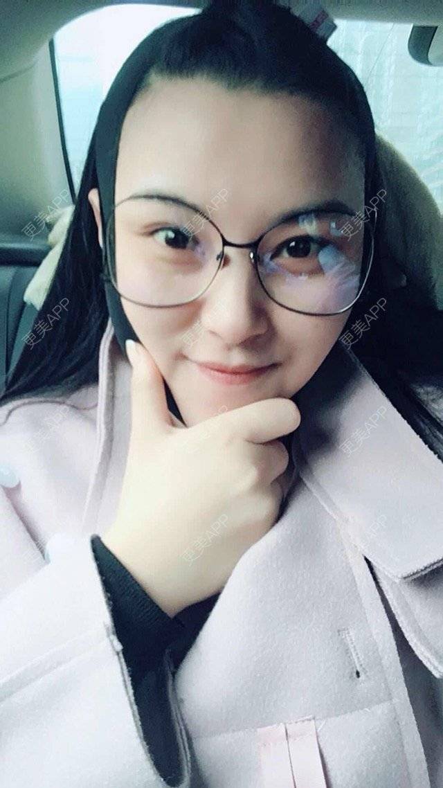 更美 - 玲珑妖的吸脂瘦大腿经验 | 长沙 | 吸脂瘦臀部 | 吸脂双下巴 | 吸脂瘦大腿