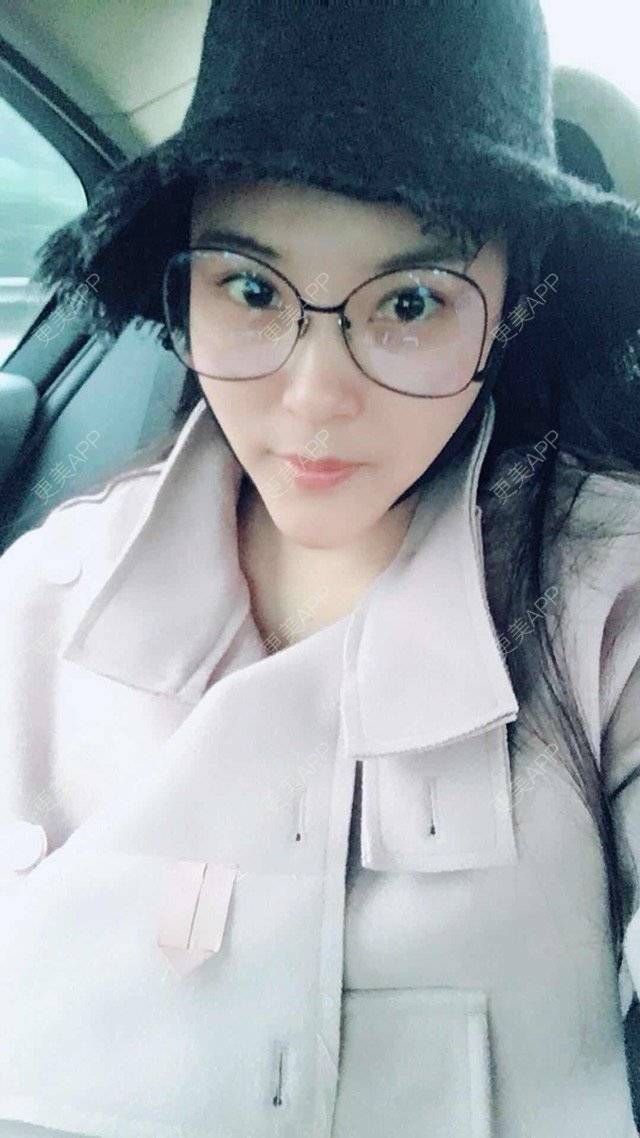 更美 - 玲珑妖的吸脂瘦大腿经验 | 长沙 | 吸脂瘦臀部 | 吸脂双下巴 | 吸脂瘦大腿
