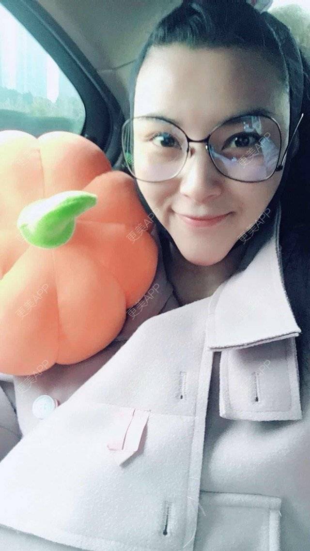 更美 - 玲珑妖的吸脂瘦大腿经验 | 长沙 | 吸脂瘦臀部 | 吸脂双下巴 | 吸脂瘦大腿