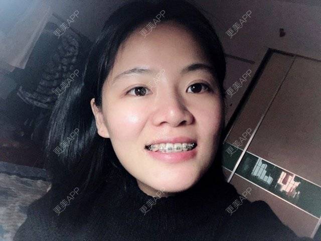 更美 - 珍珠姐的经验 | 广州
