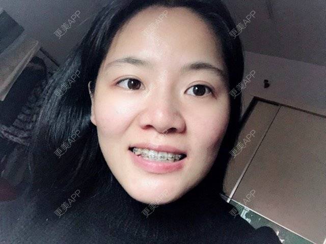 更美 - 珍珠姐的经验 | 广州