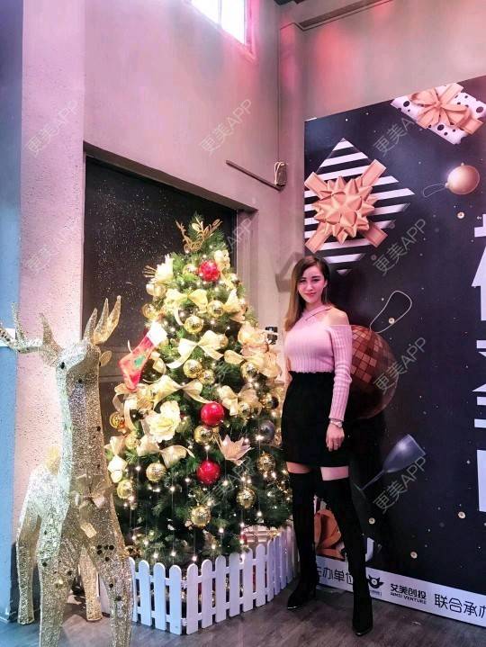 更美 - 网络主播欧美妹子的自体脂肪全面部填充经验 | 自体脂肪丰太阳穴 | 广州 | 自体脂肪全面部填充 | 自体脂肪丰额头