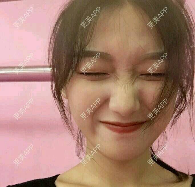 更美 - 更美用户FPW7XazJLg的水光项目经验 | 中山 | 水光项目