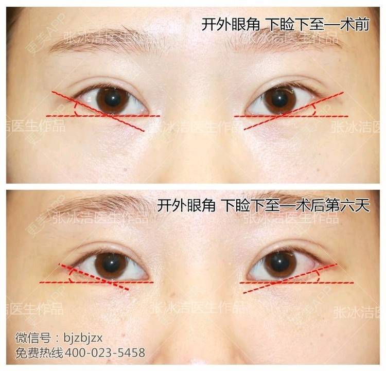 更美用户ehgryczdf6的开外眼角日记