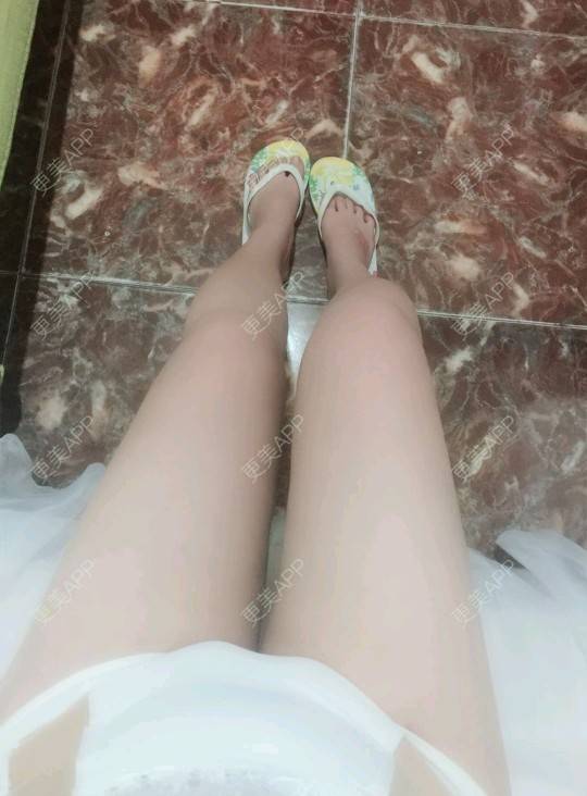 更美 - 更美用户uhjgJzL3xQ的吸脂瘦大腿经验 | 广州 | 瘦身美体 | 吸脂 | 吸脂瘦大腿