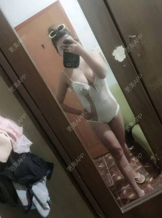更美 - 更美用户uhjgJzL3xQ的吸脂瘦大腿经验 | 广州 | 瘦身美体 | 吸脂 | 吸脂瘦大腿