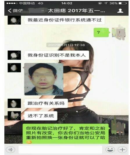 更美 - 成都恒博皮肤光学中心的皮秒激光经验 | 皮秒激光 | 去胎记 | 激光祛太田痣