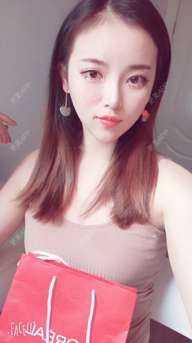更美 - 错位的梦兮的硅胶垫下巴经验 | 硅胶垫下巴 | 武汉
