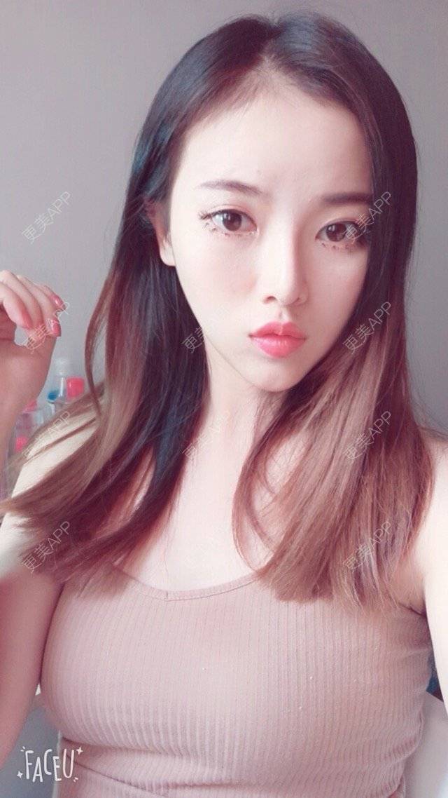 更美 - 错位的梦兮的硅胶垫下巴经验 | 硅胶垫下巴 | 武汉