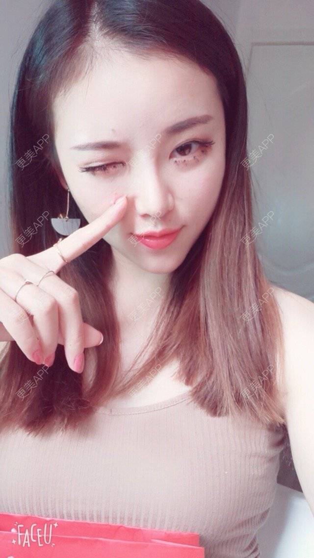 更美 - 错位的梦兮的硅胶垫下巴经验 | 硅胶垫下巴 | 武汉