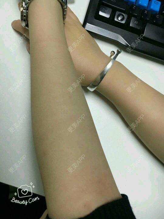 更美 - 王用洪 医生的激光脱毛经验 | 南昌 | 激光脱毛
