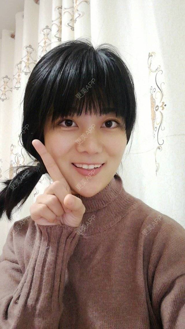 更美 - 西安高一生医疗美容医院的肋软骨隆鼻经验 | 肋软骨隆鼻 | 西安