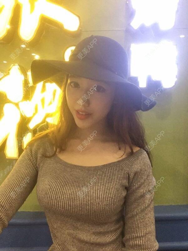 偏情的假体隆胸日记