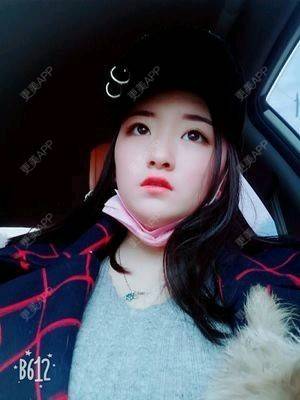 更美 - 刘兴振 医生的玻尿酸套餐经验 | 玻尿酸套餐 | 重庆