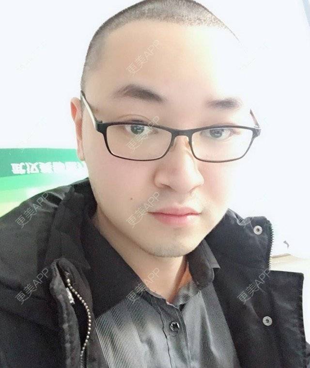 更美 - 本性难移的经验 | 种植毛发 | 移植发际线 | 武汉