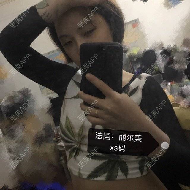 更美 - Joni小小板娘的射频溶脂瘦手臂经验 | 上海 | 射频溶脂瘦手臂