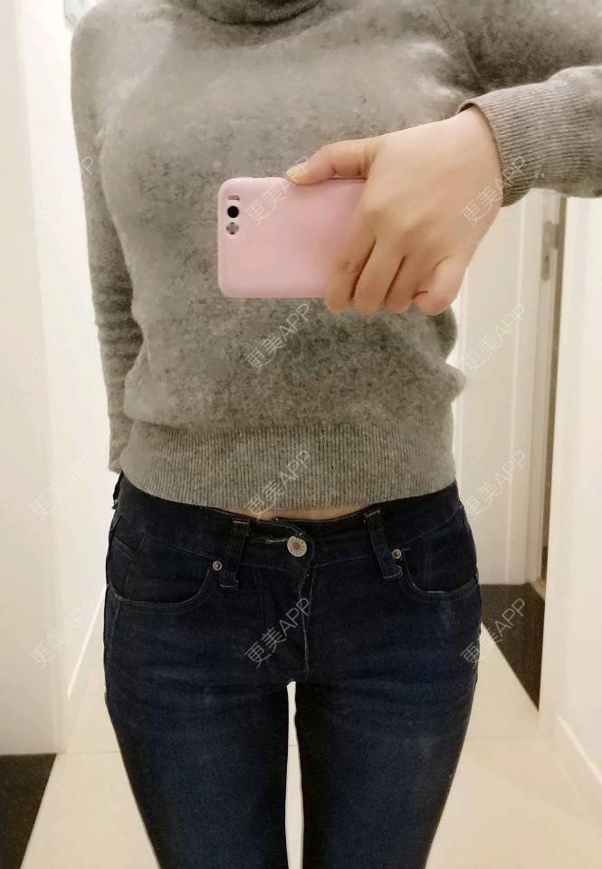 向阳葵21的腰腹吸脂日记