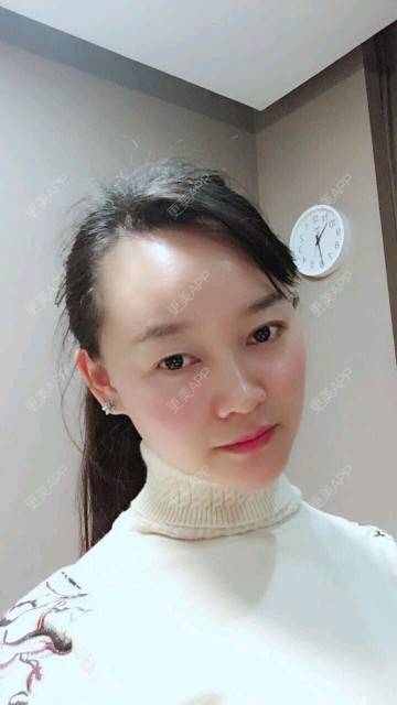 更美 - 谁说风轻云静的激光淡化红血丝经验 | 激光淡化红血丝 | 成都