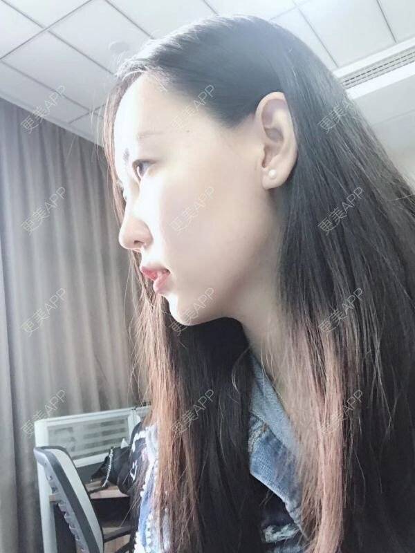 更美 - wlhh的黑脸娃娃经验 | 杭州 | 杭州同城 | 黑脸娃娃