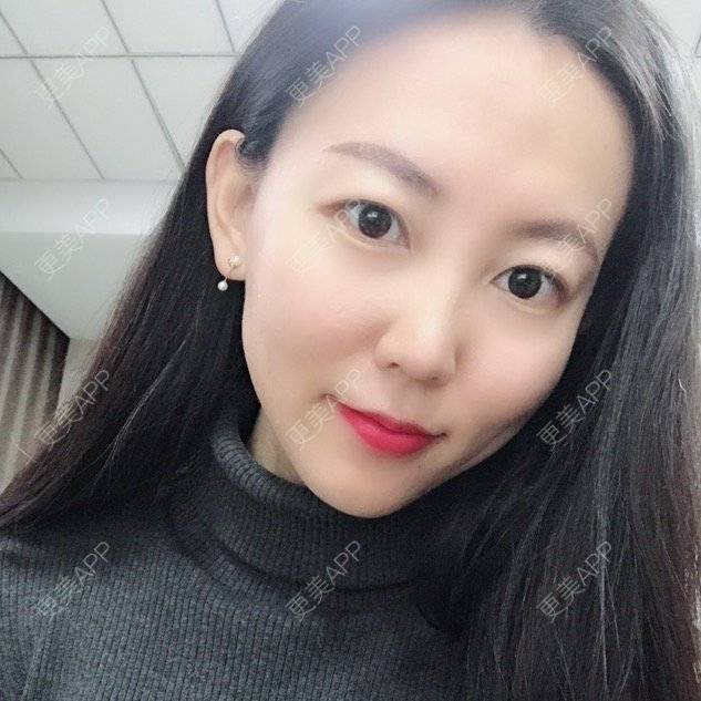 更美 - wlhh的黑脸娃娃经验 | 杭州 | 杭州同城 | 黑脸娃娃