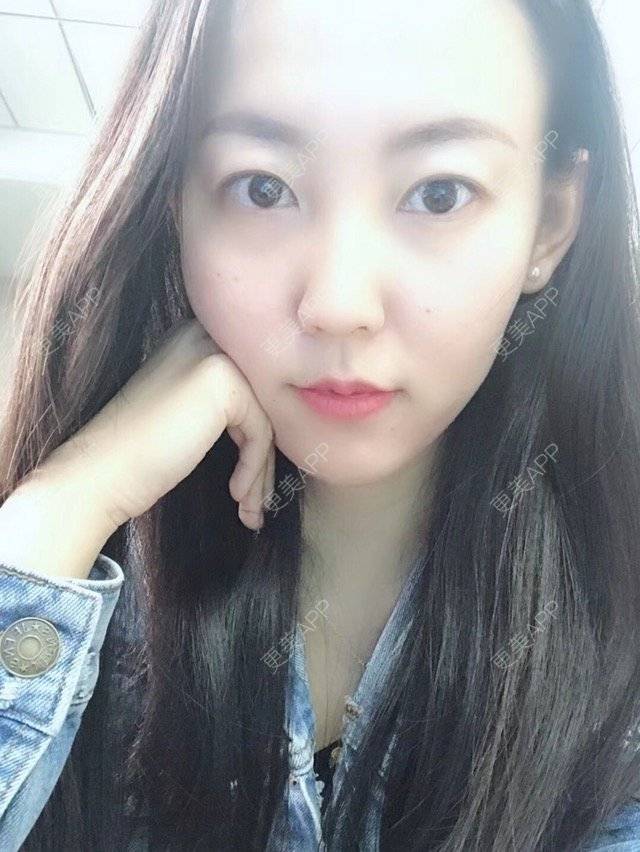 更美 - wlhh的黑脸娃娃经验 | 杭州 | 杭州同城 | 黑脸娃娃