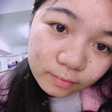 萌朦
