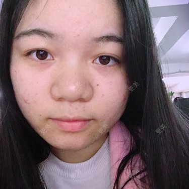 萌朦