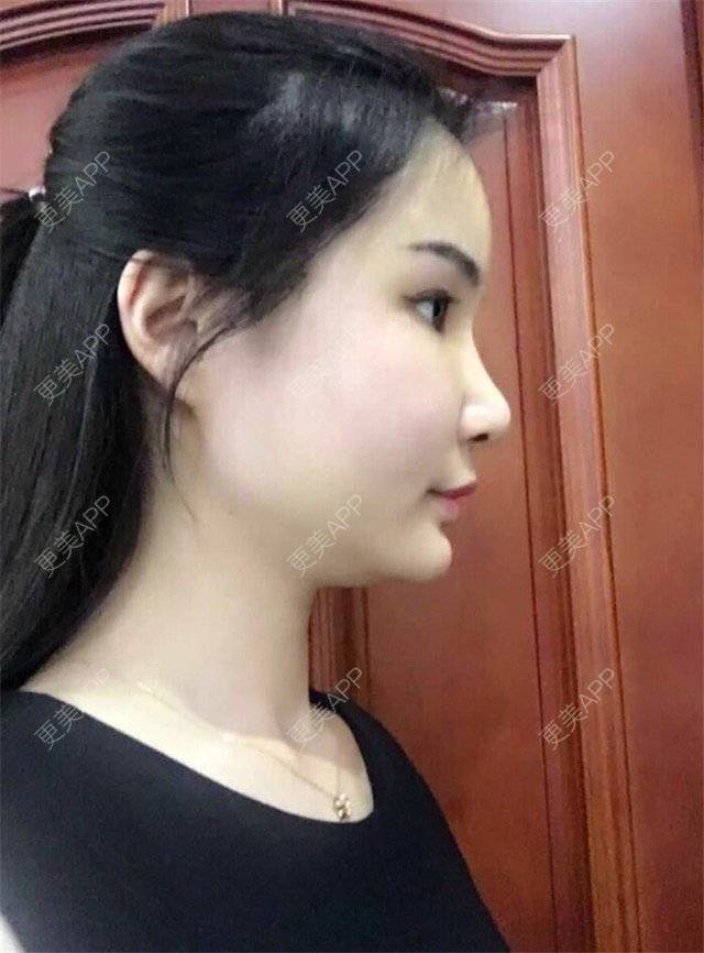 伊梦琪的日记