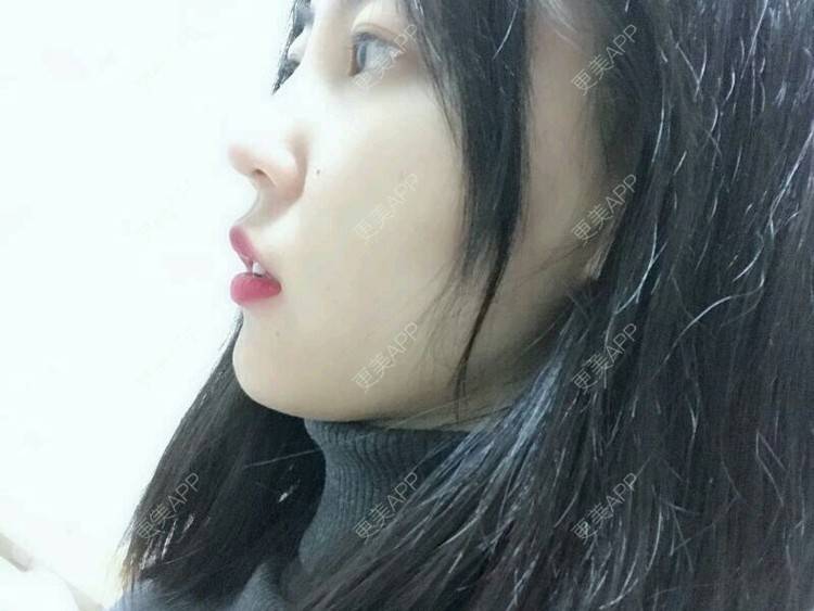 更美 - wlhh的黑脸娃娃经验 | 杭州 | 黑脸娃娃