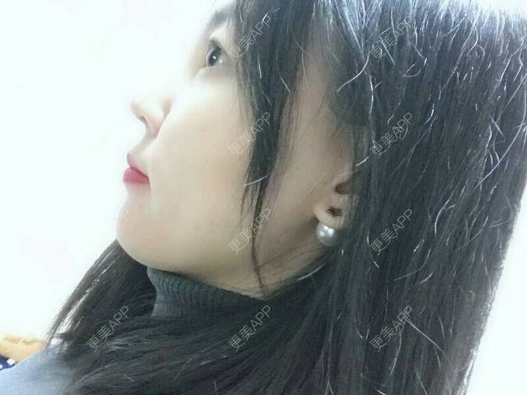 更美 - wlhh的黑脸娃娃经验 | 杭州 | 黑脸娃娃