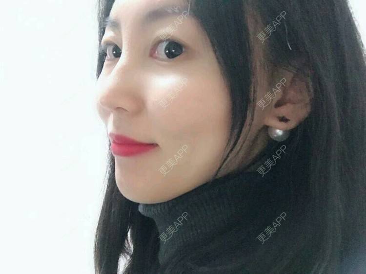 更美 - wlhh的黑脸娃娃经验 | 杭州 | 黑脸娃娃