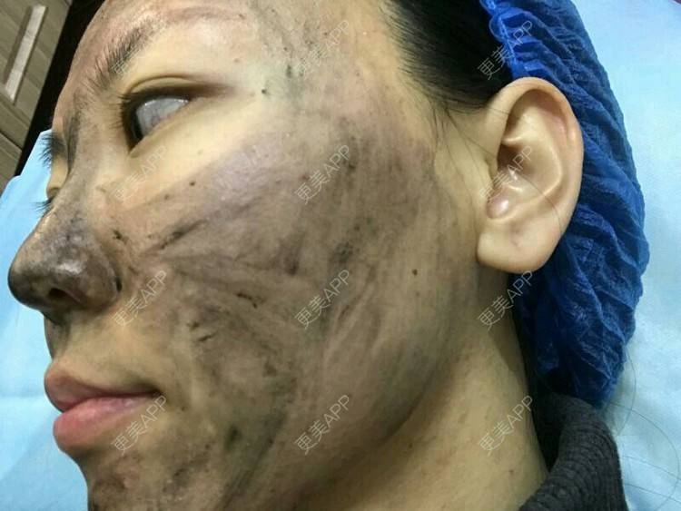 更美 - wlhh的黑脸娃娃经验 | 杭州 | 黑脸娃娃